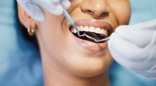 Best After-Hours Dental Trauma Care in Forks, WA